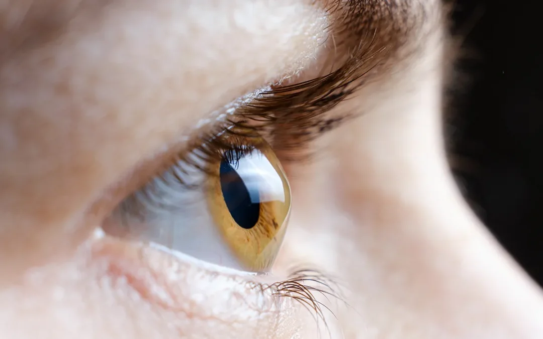 How Specialty Contact Lenses for Keratoconus Improve Vision
